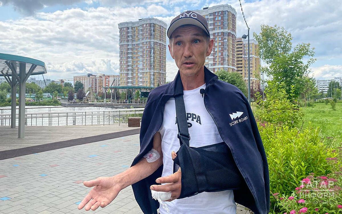 «Выскочила, впилась в палец и повисла на нем»: история казанца, которого укусила гадюка