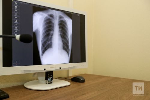 12 ноября отмечается Всемирный день борьбы с пневмонией