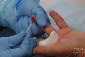 5 фактов о ВИЧ, которые должен знать любой молодой человек
