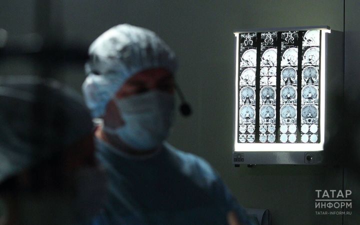 Всемирный день мозга: история, значение и советы по уходу за главным органом